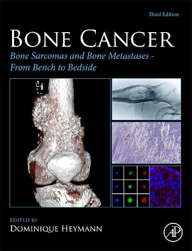 Cover image for Bone Cancer: Bone Sarcomas and Bone Metastases From Bench to Bedside