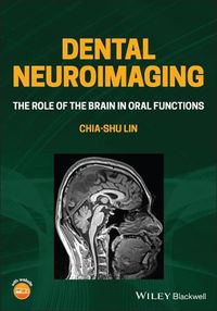 Cover image for Dental Neuroimaging: The Role of the Brain in Oral Functions