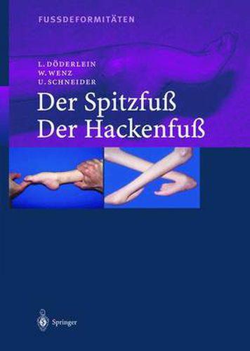 Cover image for Fussdeformitaten: Der Spitzfu / Der Hackenfu