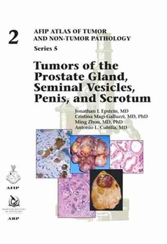 Cover image for Tumors of the Prostate Gland, Seminal Vesicles, Penis, and Scrotum