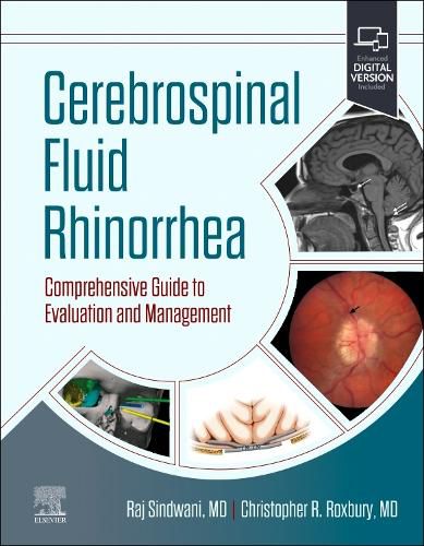 Cover image for Cerebrospinal Fluid Rhinorrhea