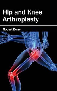 Cover image for Hip and Knee Arthroplasty