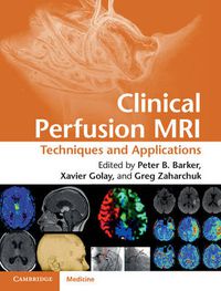 Cover image for Clinical Perfusion MRI: Techniques and Applications