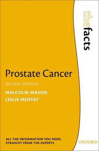 Cover image for Prostate Cancer