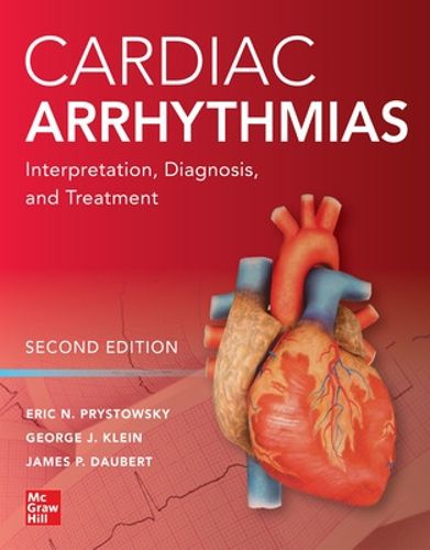 Cover image for Cardiac Arrhythmias: Interpretation, Diagnosis and Treatment, Second Edition