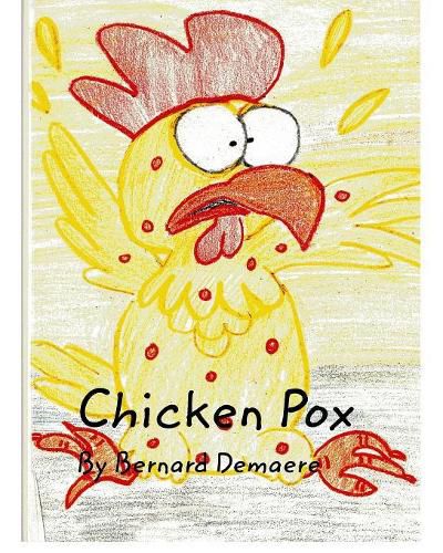 Cover image for Chicken Pox