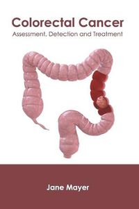 Cover image for Colorectal Cancer: Assessment, Detection and Treatment