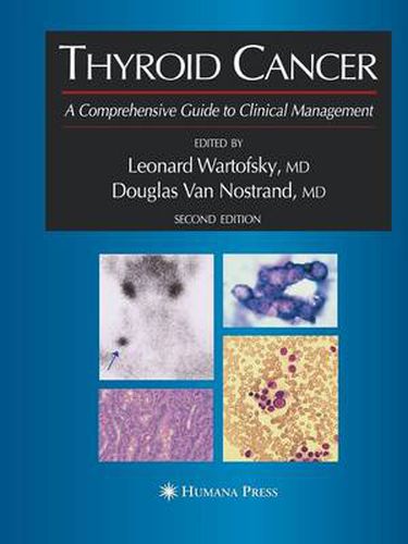 Cover image for Thyroid Cancer: A Comprehensive Guide to Clinical Management