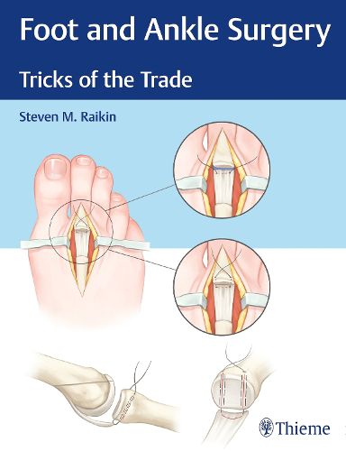 Cover image for Foot and Ankle Surgery: Tricks of the Trade