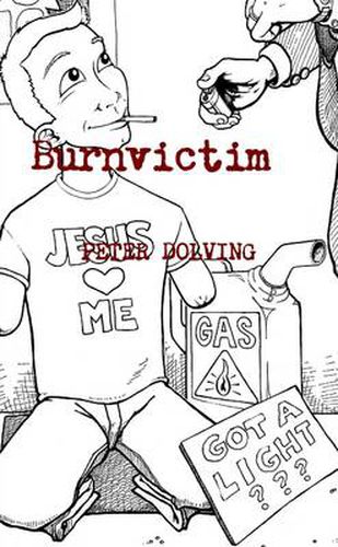 Burnvictim