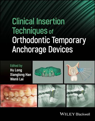 Cover image for Clinical Insertion Techniques of Orthodontic Temporary Anchorage Devices