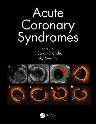 Cover image for Acute Coronary Syndromes