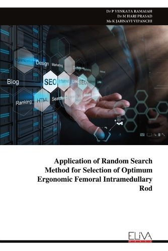 Cover image for Application of Random Search Method for Selection of Optimum Ergonomic Femoral Intramedullary Rod