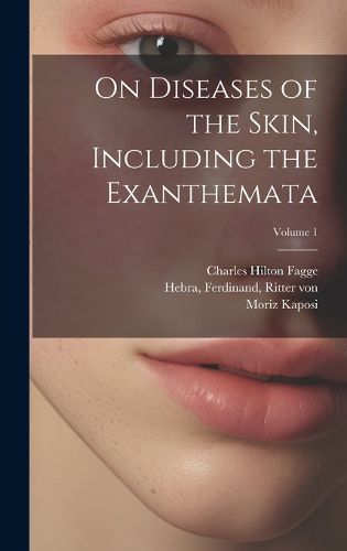 Cover image for On Diseases of the Skin, Including the Exanthemata; Volume 1