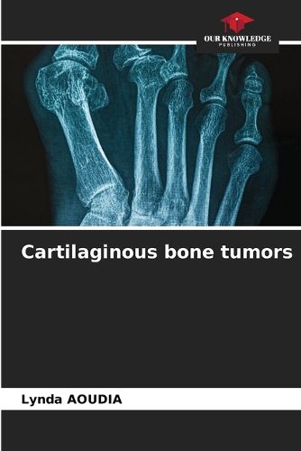 Cover image for Cartilaginous bone tumors