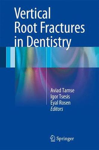 Cover image for Vertical Root Fractures in Dentistry