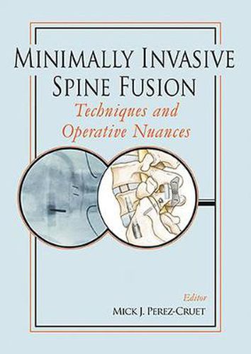 Cover image for Minimally Invasive Spine Fusion: Techniques and Operative Nuances