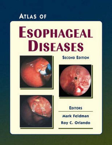Cover image for Atlas of Esophageal Diseases
