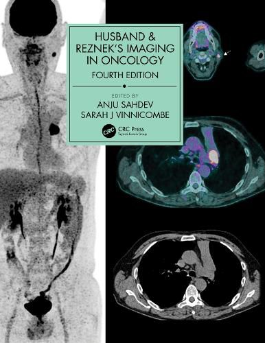 Cover image for Husband & Reznek's Imaging in Oncology