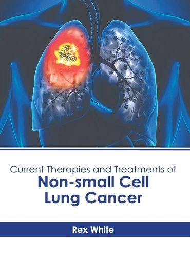 Cover image for Current Therapies and Treatments of Non-Small Cell Lung Cancer