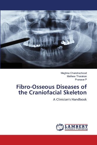 Cover image for Fibro-Osseous Diseases of the Craniofacial Skeleton