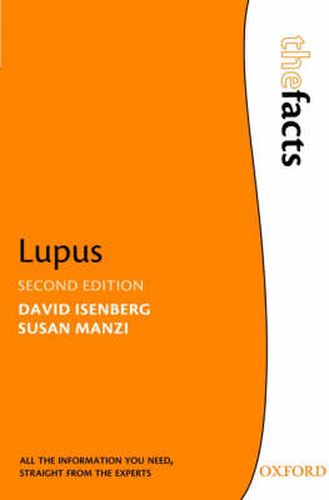 Cover image for Lupus