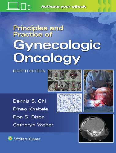 Cover image for Principles and Practice of Gynecologic Oncology