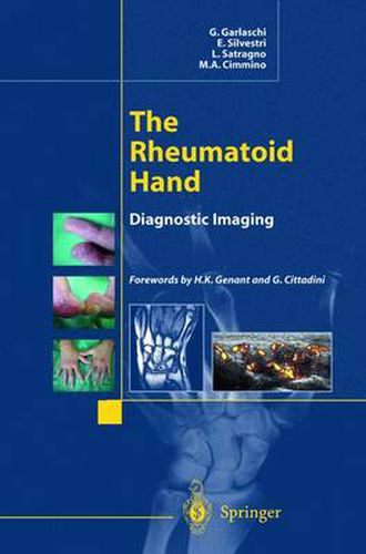 Cover image for The Rheumatoid Hand: Diagnostic Imaging