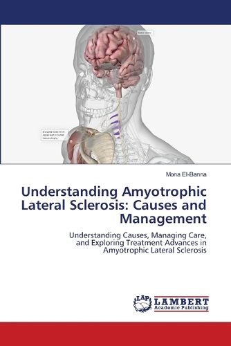 Cover image for Understanding Amyotrophic Lateral Sclerosis