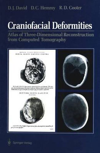 Cover image for Craniofacial Deformities: Atlas of Three-Dimensional Reconstruction from Computed Tomography