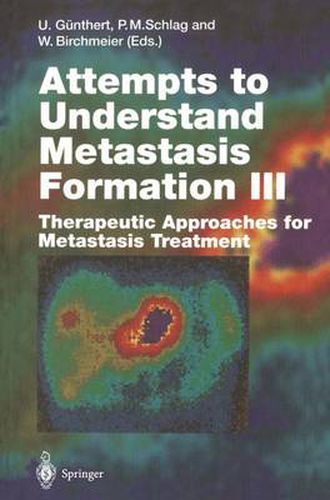 Cover image for Attempts to Understand Metastasis Formation III: Therapeutic Approaches for Metastasis Treatment