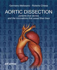 Cover image for Aortic Dissection: Patients True Stories and the Innovations that Saved their Lives