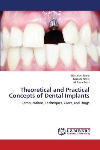 Cover image for Theoretical and Practical Concepts of Dental Implants