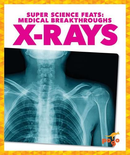 X-Rays