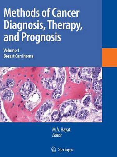 Cover image for Methods of Cancer Diagnosis, Therapy and Prognosis: Breast Carcinoma
