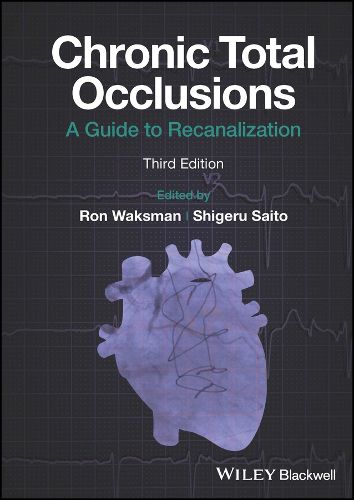 Cover image for Chronic Total Occlusions: A Guide to Recanalization