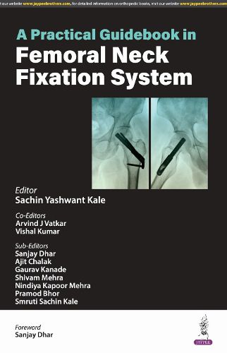 Cover image for A Practical Guidebook in Femoral Neck Fixation System