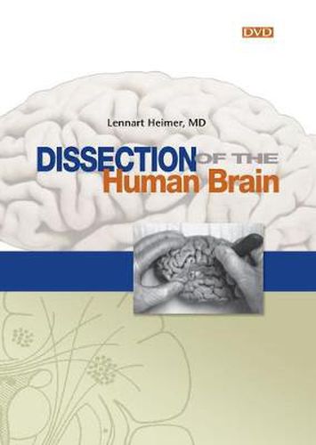 Cover image for Dissection of the Human Brain