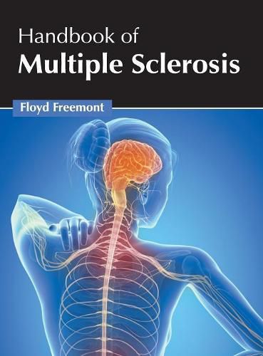 Cover image for Handbook of Multiple Sclerosis