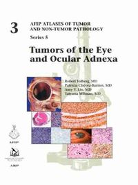 Cover image for Tumors of the Eye and Ocular Adnexa