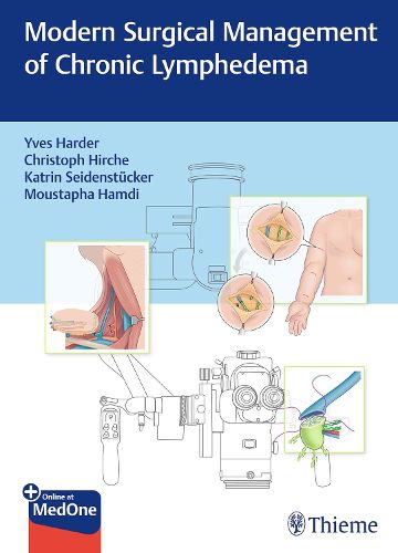 Cover image for Modern Surgical Management of Chronic Lymphedema