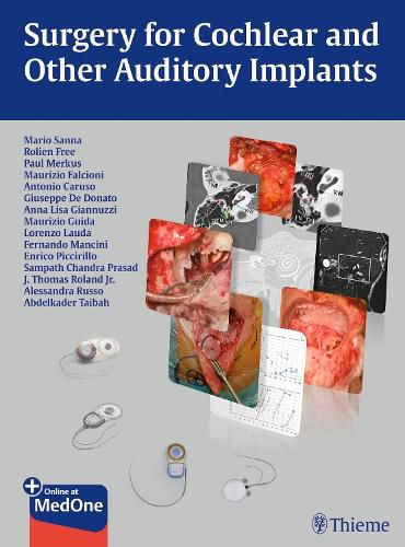 Cover image for Surgery for Cochlear and Other Auditory Implants