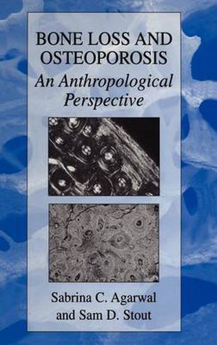 Cover image for Bone Loss and Osteoporosis: An Anthropological Perspective