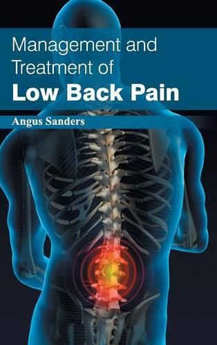 Cover image for Management and Treatment of Low Back Pain