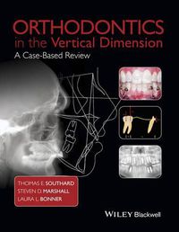 Cover image for Orthodontics in the Vertical Dimension - A Case-Based Review