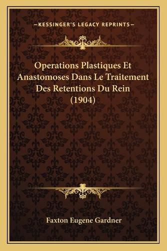 Cover image for Operations Plastiques Et Anastomoses Dans Le Traitement Des Retentions Du Rein (1904)