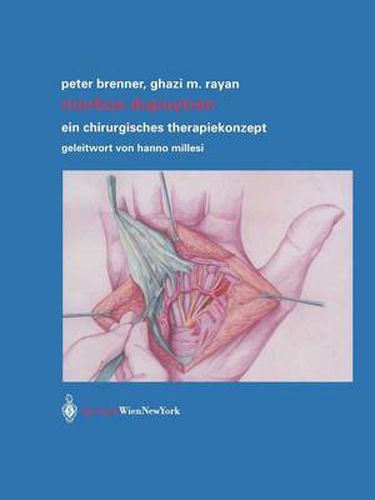 Cover image for Morbus Dupuytren: Ein Chirurgisches Therapiekonzept