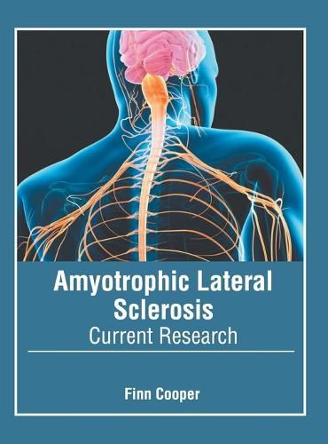 Cover image for Amyotrophic Lateral Sclerosis: Current Research