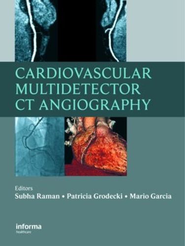 Cover image for Cardiovascular Multidetector CT Angiography