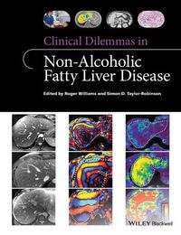 Cover image for Clinical Dilemmas in Non-Alcoholic Fatty Liver Disease